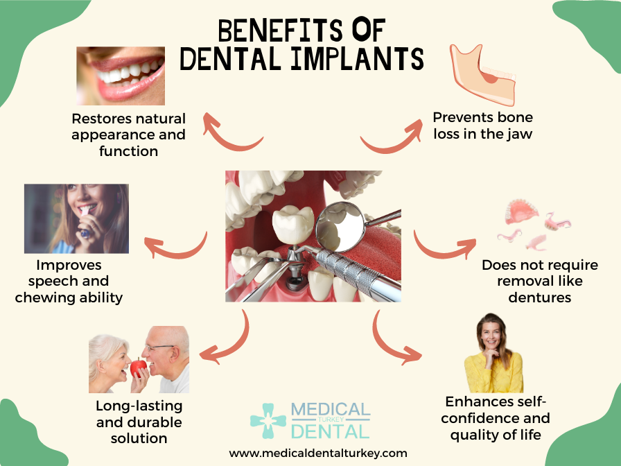 Benefits of Dental Implant Antalya - Infographic